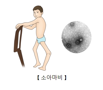 소아마비