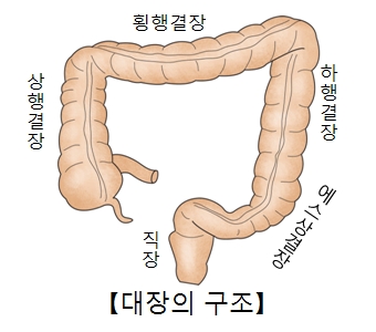 대장염