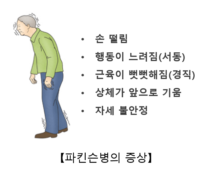 파킨슨병