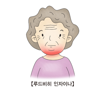 루드비히 앙기나