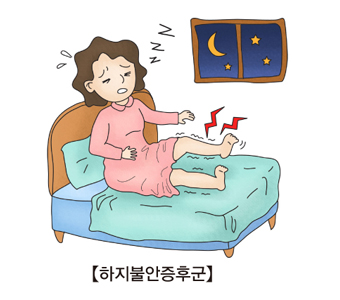 하지불안증후군