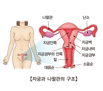 자궁내막 용종