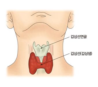 갑상선의 위치 그림